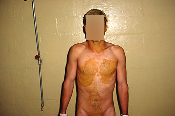 abu-ghraib7